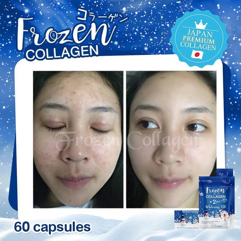 Gluta Frozen Collagen 2-in-1 Beauty Capsules — 60 Capsules